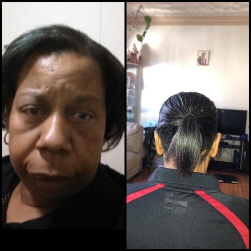Kinks Hair Growth Oil
